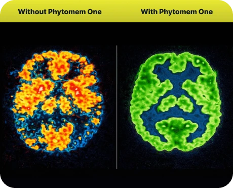 Illustration contrasting scattered versus focused brain activity